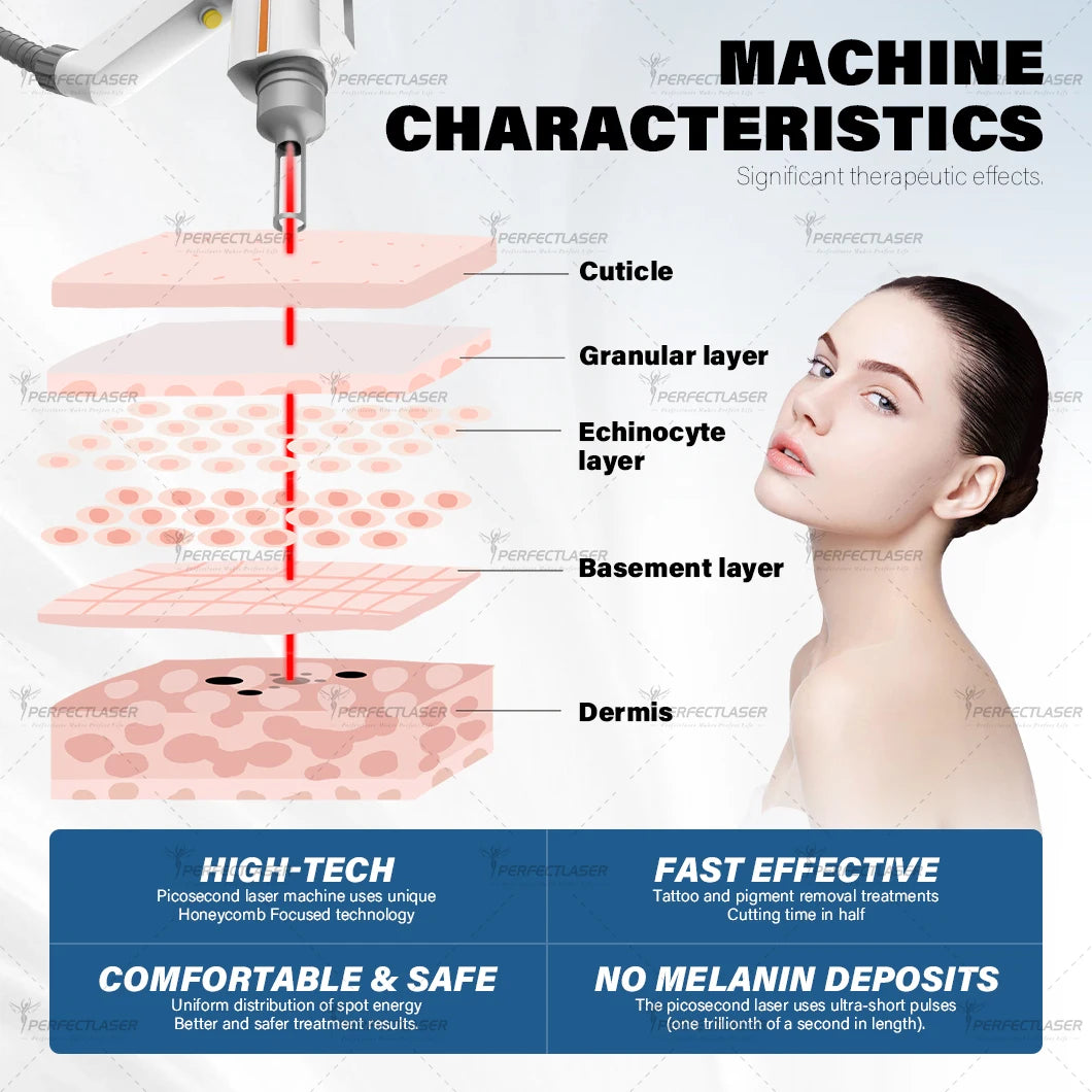 Machine Laser Picoseconde PerfectLaser – Détatouage, Taches & Rajeunissement Cutané Professionnel