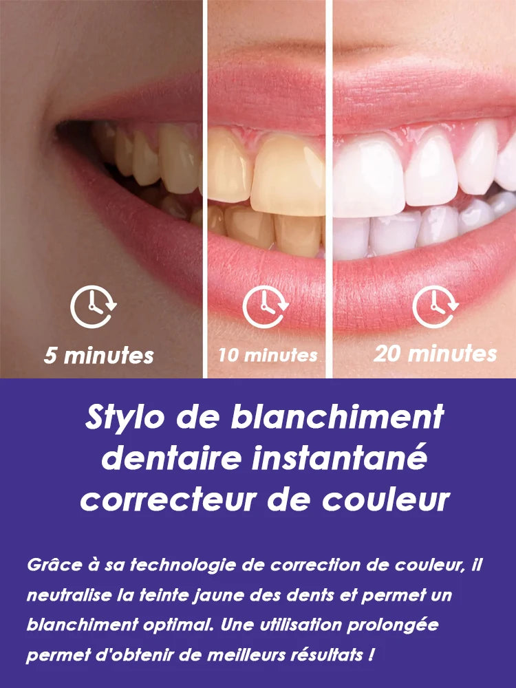 Stylo Blanchissant Dents Violet | Blanchiment Instantané Sans Sensibilité