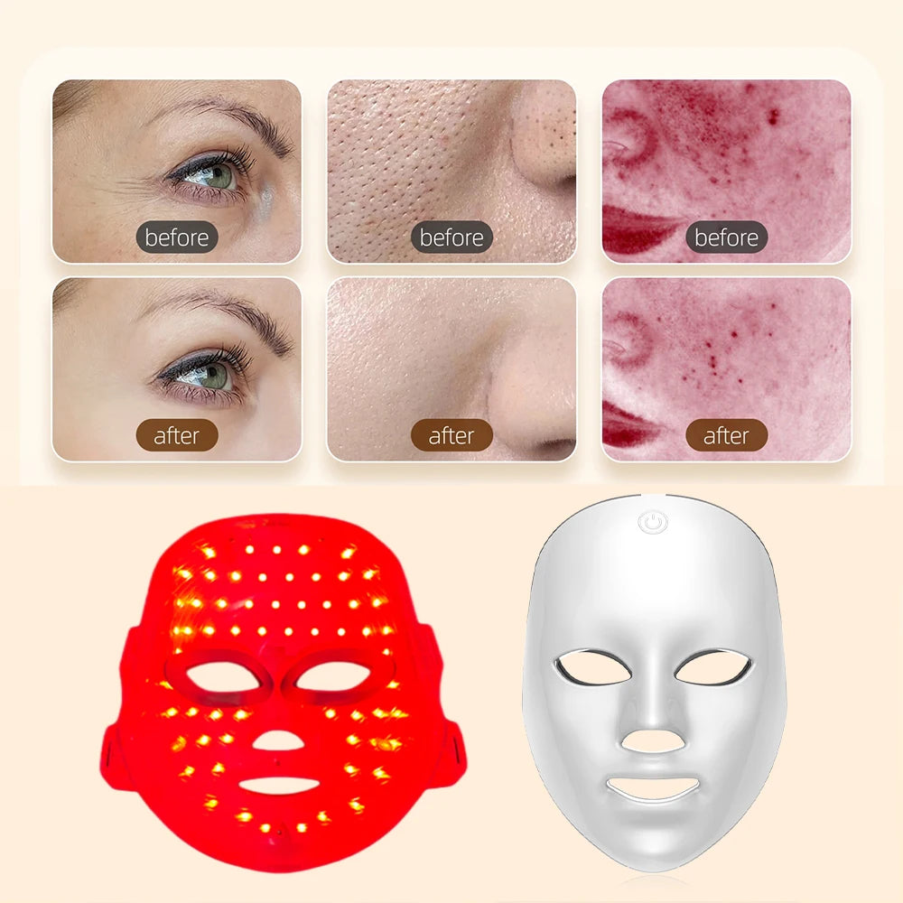 Masque LED Visage 7 Couleurs | Photothérapie Anti-Rides, Anti-Acné & Éclat