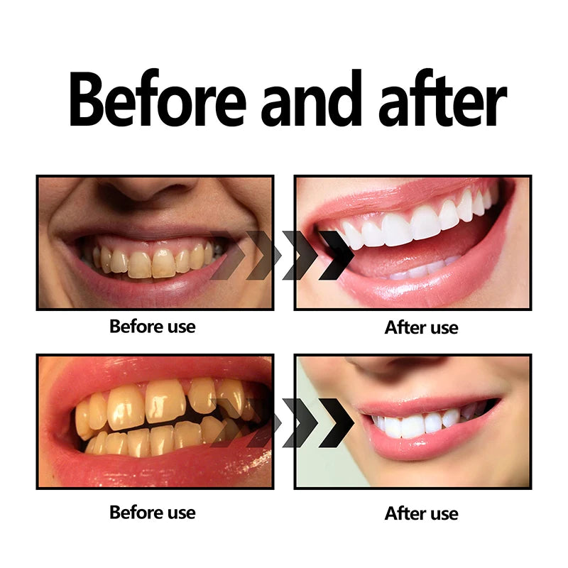 Poudre Blanchissante Naturelle – Nettoyage Profond, Dents Éclatantes & Haleine Fraîche 50g