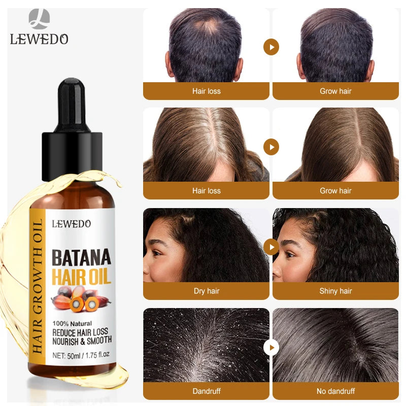 Sérum Huile Batana Croissance Cheveux – CLEVI Paris