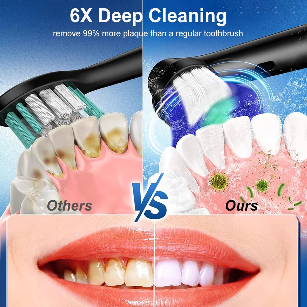 Brosse à Dents Électrique Rotative | 5 Modes Blanchiment IP67 | 30 Jours Autonomie + 4/8 Têtes – CLEVI Paris
