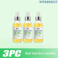 Essence Capillaire Ginger King Hair Care | Huile de Gingembre | Soin Cuir Chevelu & Anti-Chute | Unisexe – CLEVI Paris