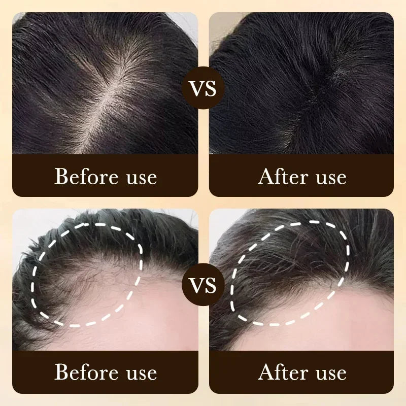 Huile Sérum Capillaire à la Biotine | Anti-Chute & Croissance Rapide | Massage Cuir Chevelu | Unisexe – CLEVI Paris