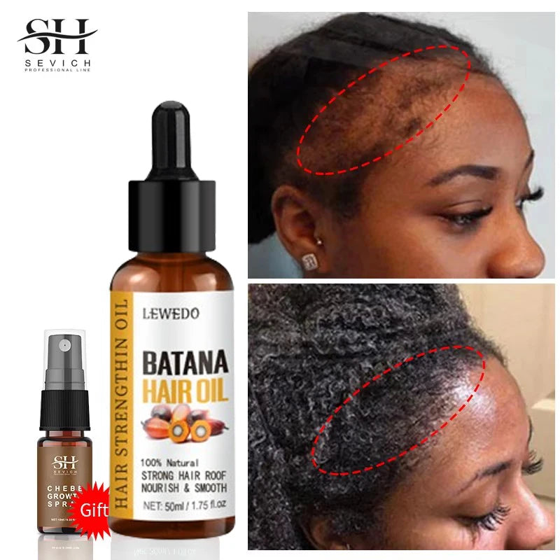 Sérum Huile Batana Croissance Cheveux – CLEVI Paris