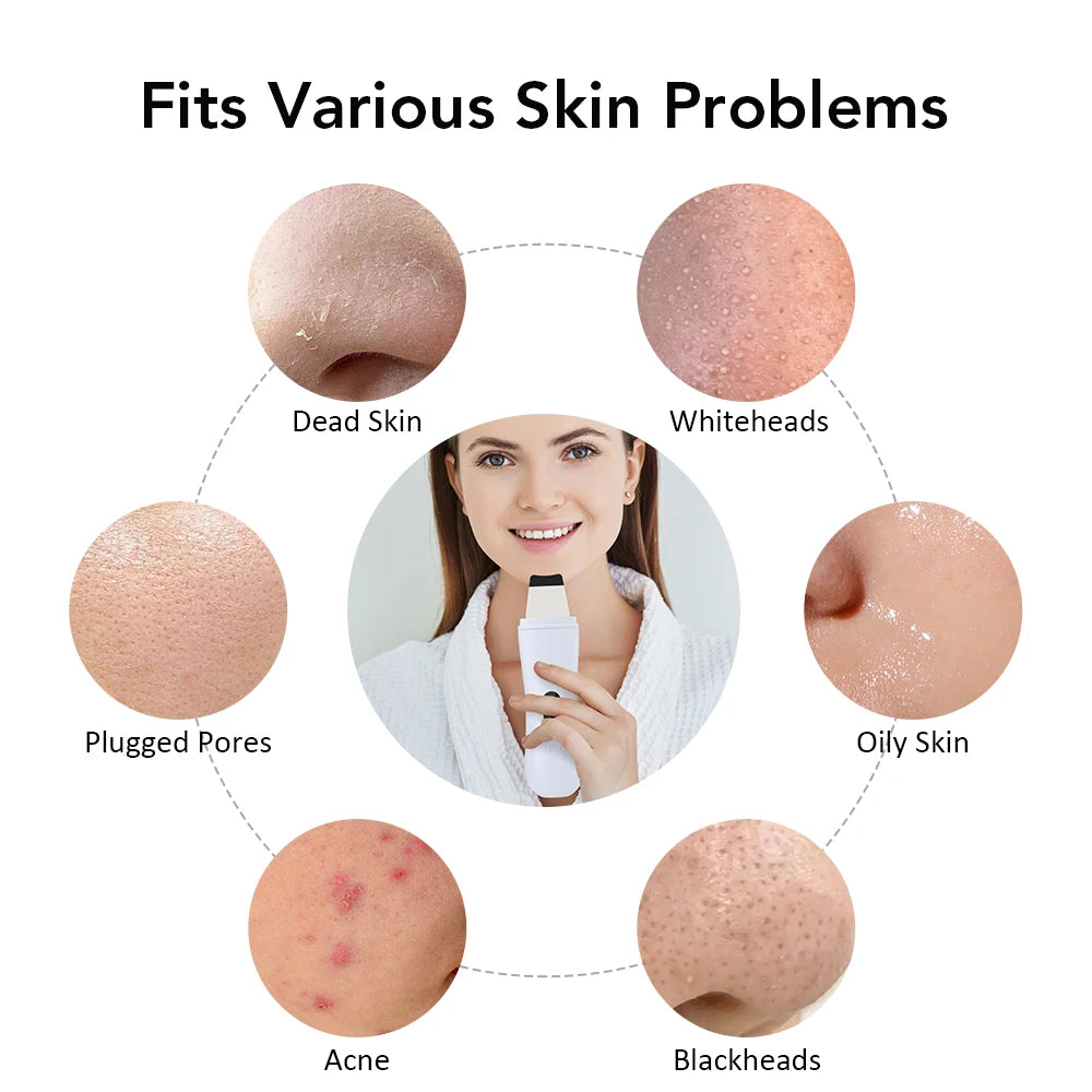 Spatule Ultrasonique Nettoyante Visage | Anti-Points Noirs & Lifting EMS