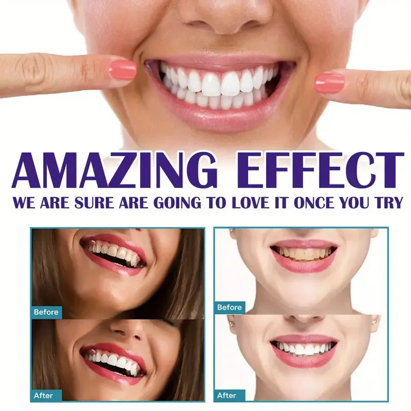 Dentifrice Mousse Blanchissant V99 | Blanchiment Naturel & Anti-Taches | Soin Gencives – CLEVI Paris