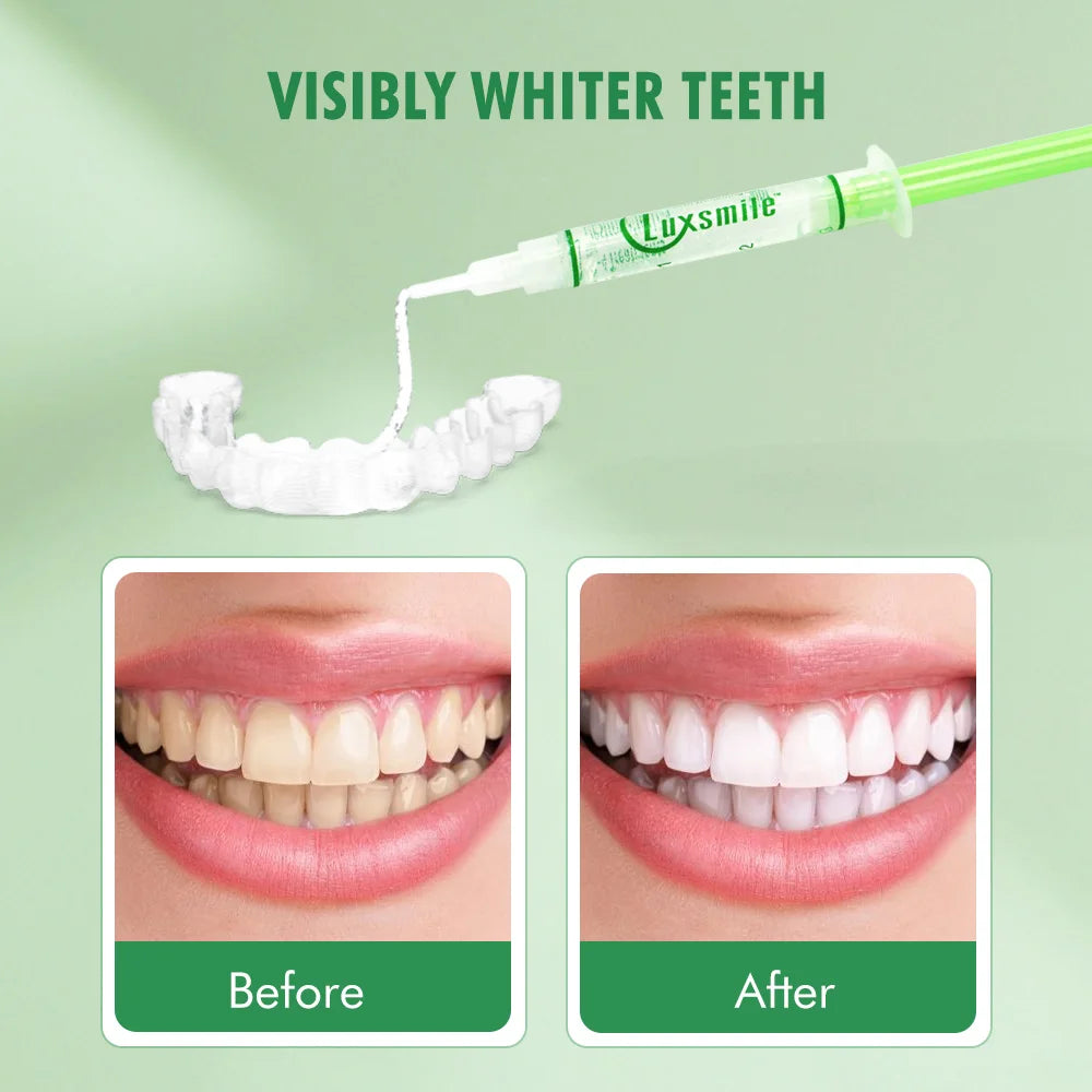 Kit Blanchiment Dentaire PAP Luxsmile | 15 Doses Gel + Lumière LED | Sans Peroxyde, Dents Sensibles – CLEVI Paris