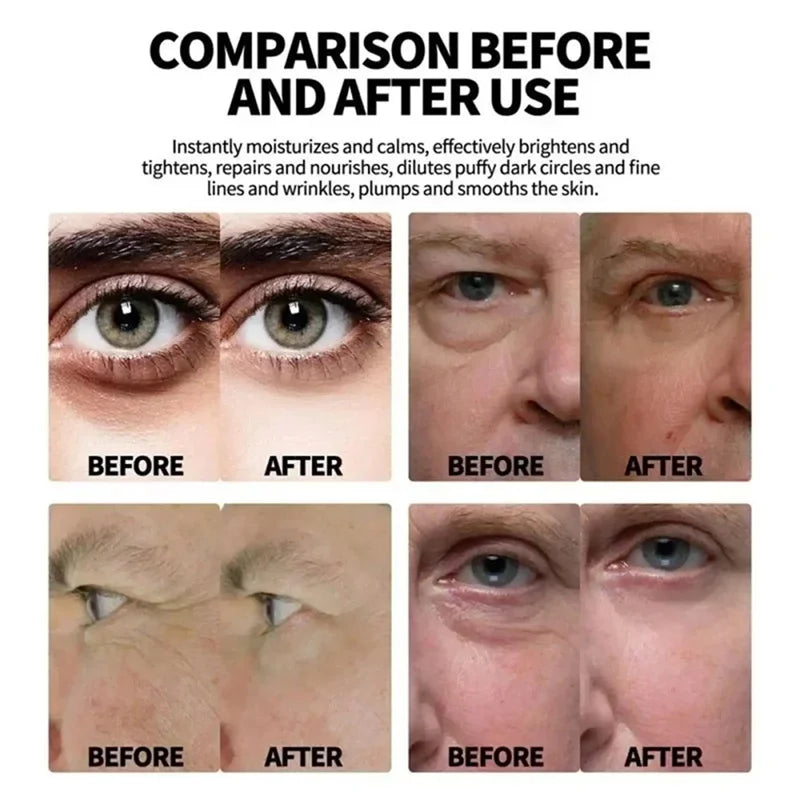 Crème Contour des Yeux Collagène Anti-Cernes Poches & Rides Homme – CLEVI Paris