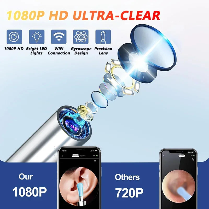 Otoscope Connecté WiFi avec Caméra HD 1080P Nettoyeur Auriculaire Visuel — CLEVI Paris