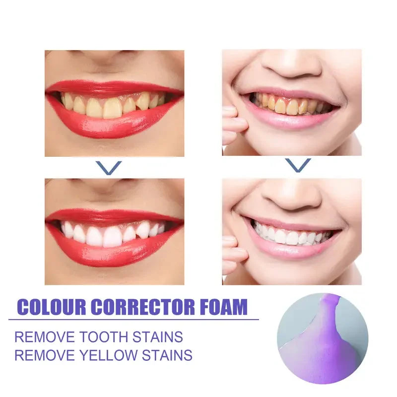 Dentifrice Mousse Blanchissant V99 | Blanchiment Naturel & Anti-Taches | Soin Gencives – CLEVI Paris