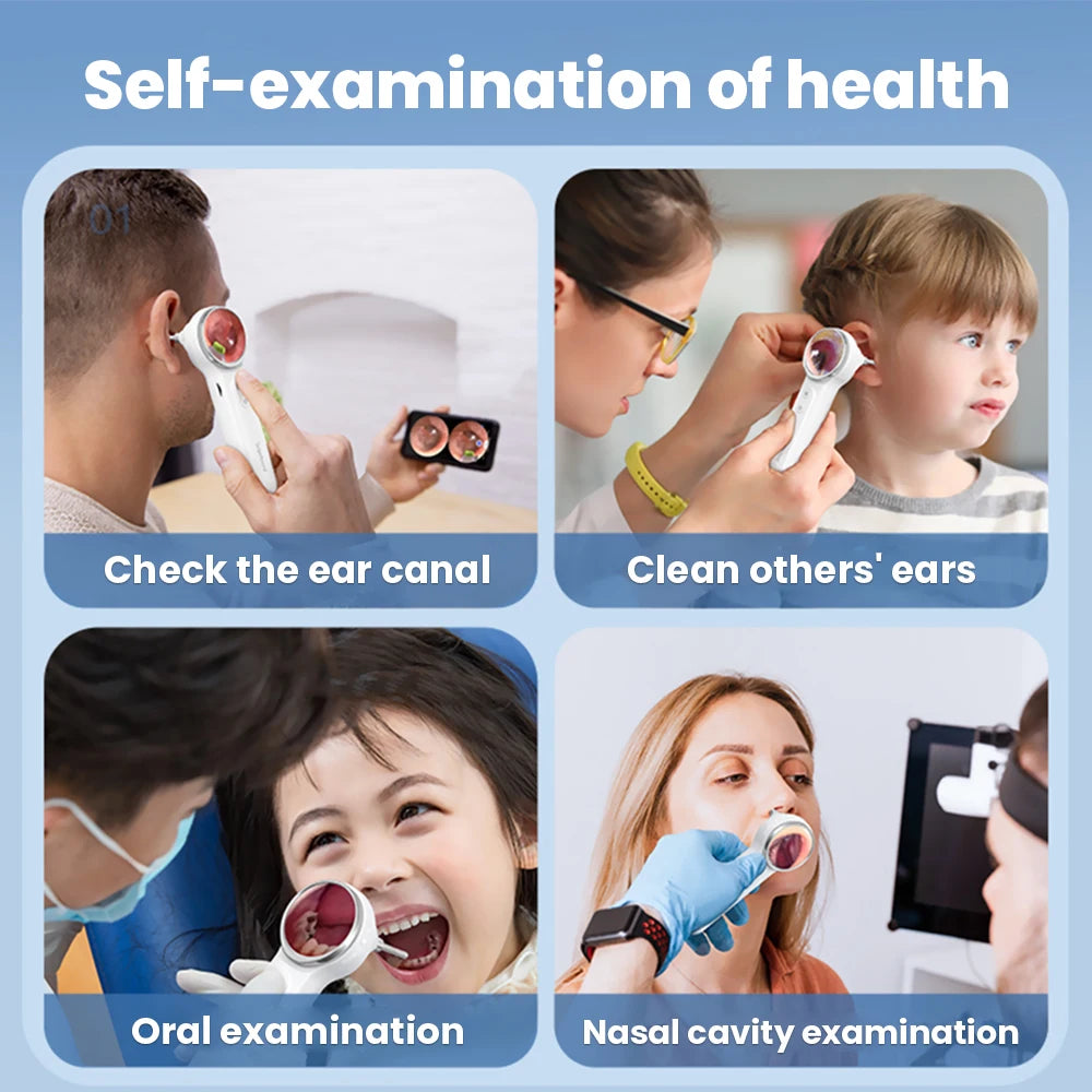 Otoscope Numérique Sinohero SA200 Écran IPS 1,85" Objectif 3,9mm 6 LED 8Go – CLEVI Paris