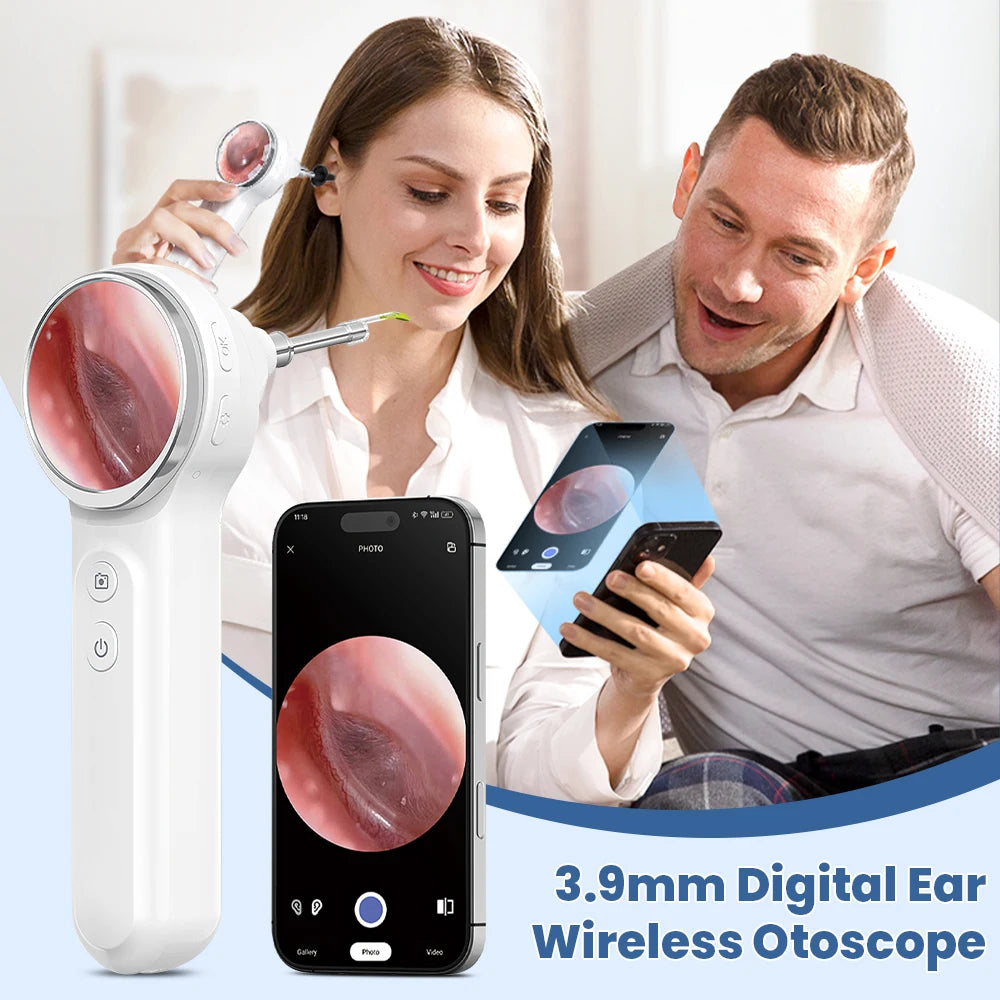 Otoscope Numérique Sinohero SA200 Écran IPS 1,85" Objectif 3,9mm 6 LED 8Go – CLEVI Paris