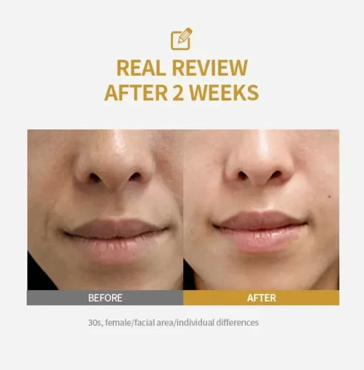 Essence Concentrée PDRN Visage Hydratation & Régénération Tous Types de Peau – CLEVI Paris