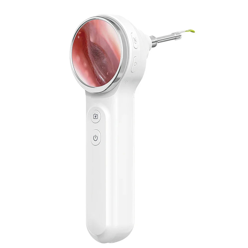 Otoscope Numérique Sinohero SA200 Écran IPS 1,85" Objectif 3,9mm 6 LED 8Go – CLEVI Paris