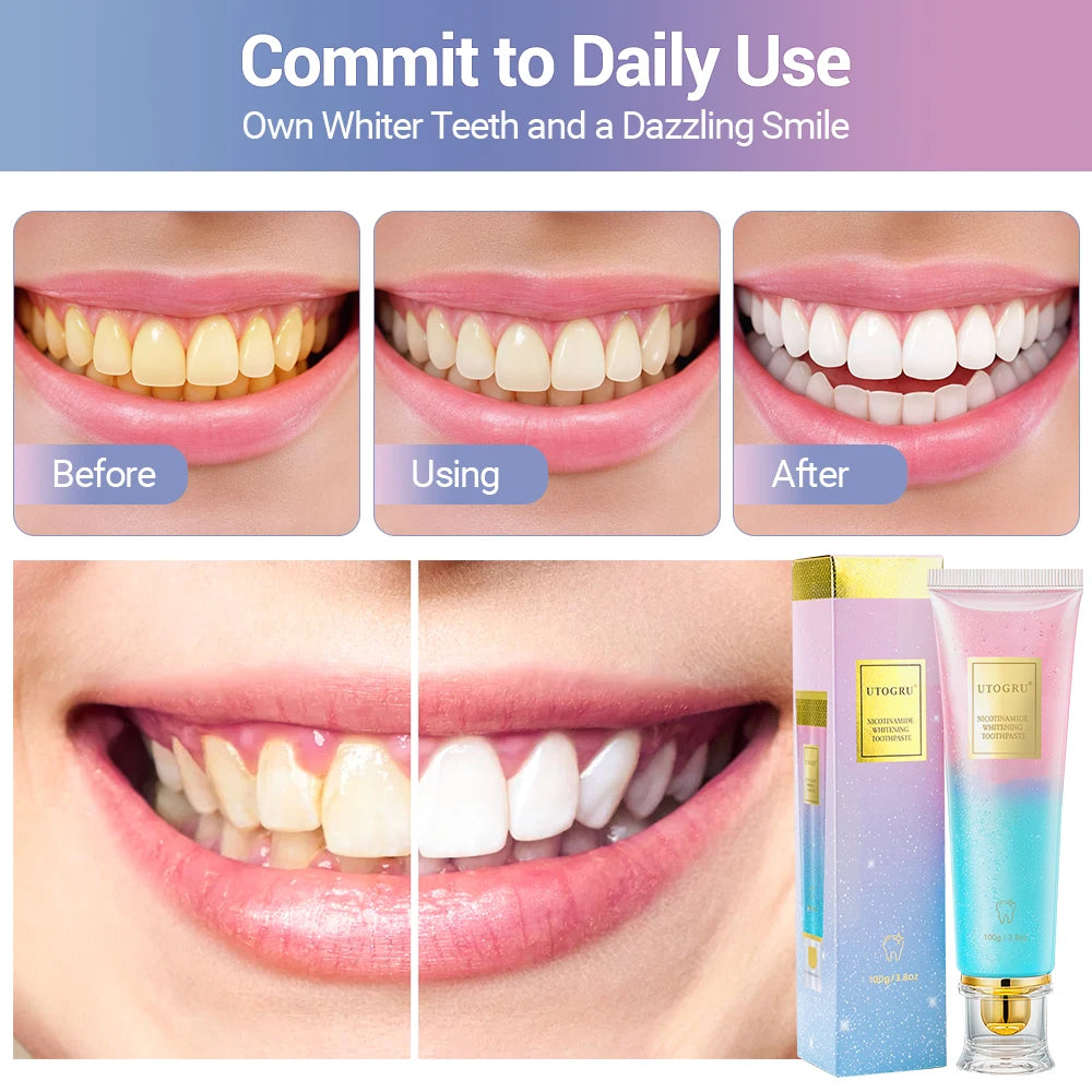 Dentifrice Blancheur Niacinamide Anti-Taches Haleine Fraîche Dents Sensibles 100g – CLEVI Paris