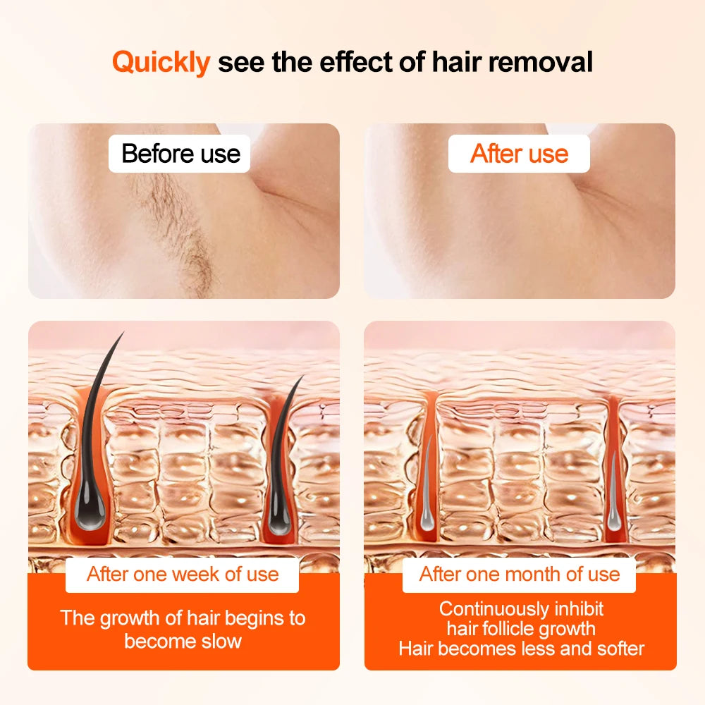 Epilateur IPL DOCTODD Carevia I6 | Refroidissement Saphir | Épilation Indolore Permanente Corps & Visage – CLEVI Paris