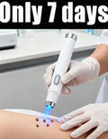 Stylo Laser Lumière Bleue Anti-Verrues | Dernière Génération | Efficacité +50% – CLEVI Paris