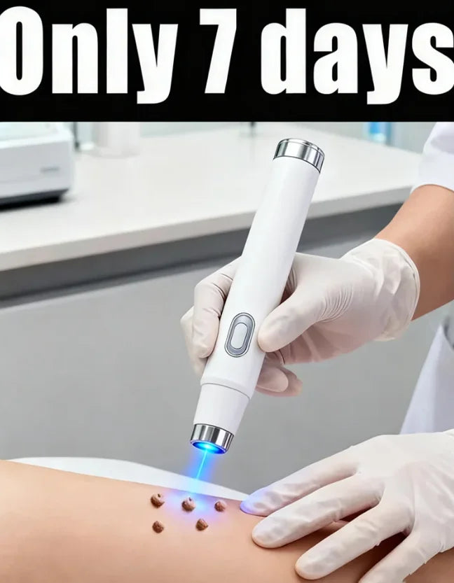 Stylo Laser Lumière Bleue Anti-Verrues | Dernière Génération | Efficacité +50% – CLEVI Paris