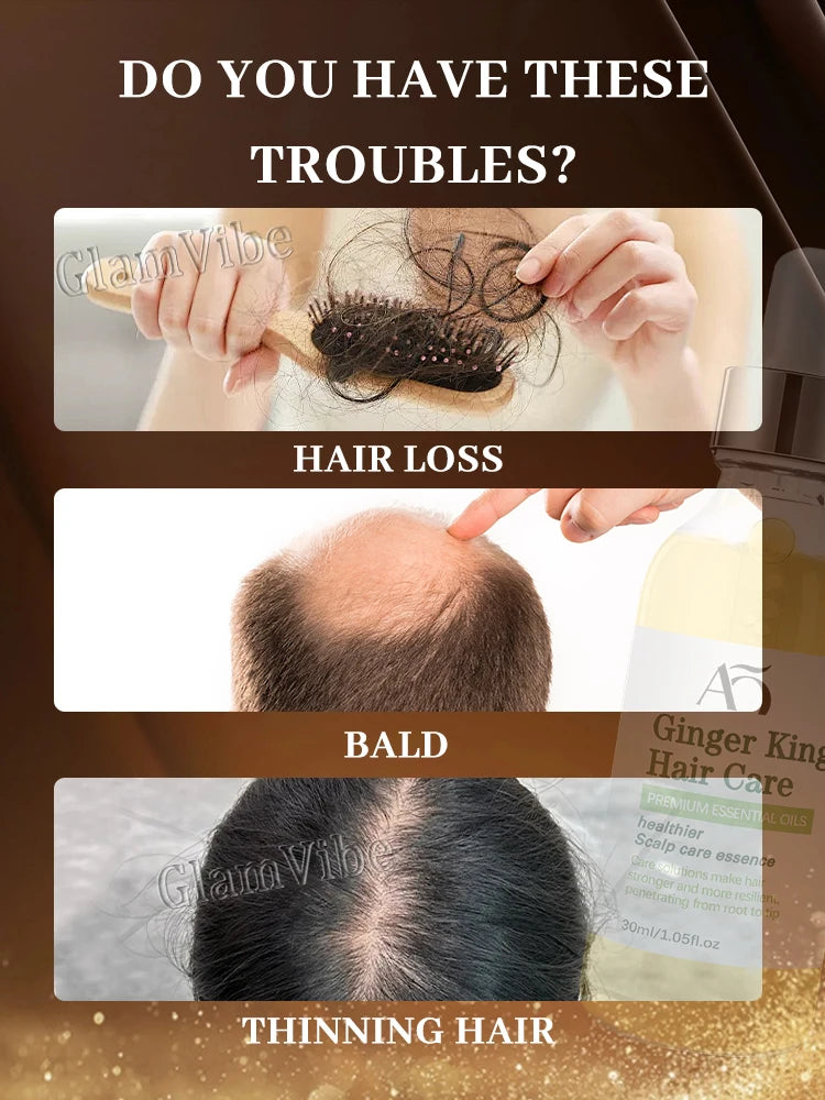 Essence Capillaire Ginger King Hair Care | Huile de Gingembre | Soin Cuir Chevelu & Anti-Chute | Unisexe – CLEVI Paris