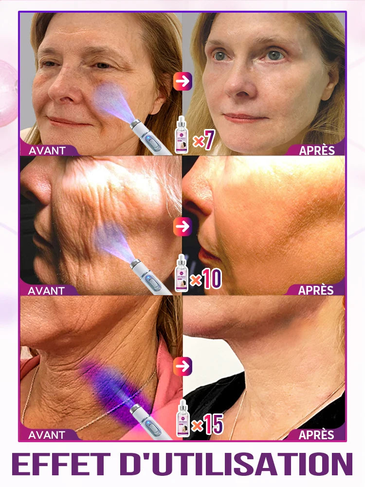 Kit Stylo Applicateur & Sérum Anti-Rides Visage | Essence Anti-Wrinkle | Unisexe – CLEVI Paris