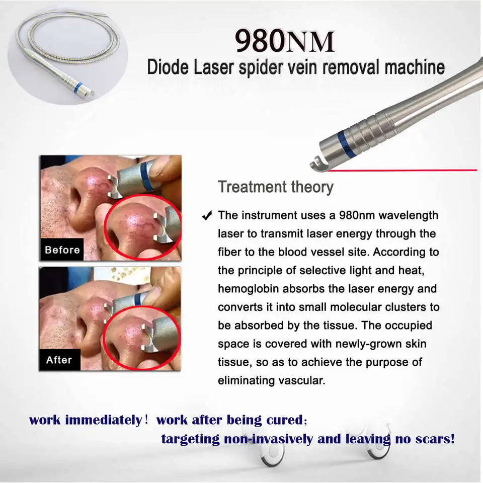 Machine Laser Diode 980nm Varicosités & Veines Araignées YUCAN | 110V / 220V – CLEVI Paris