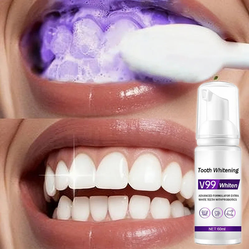 Dentifrice Mousse Blanchissant V99 | Blanchiment Naturel & Anti-Taches | Soin Gencives – CLEVI Paris