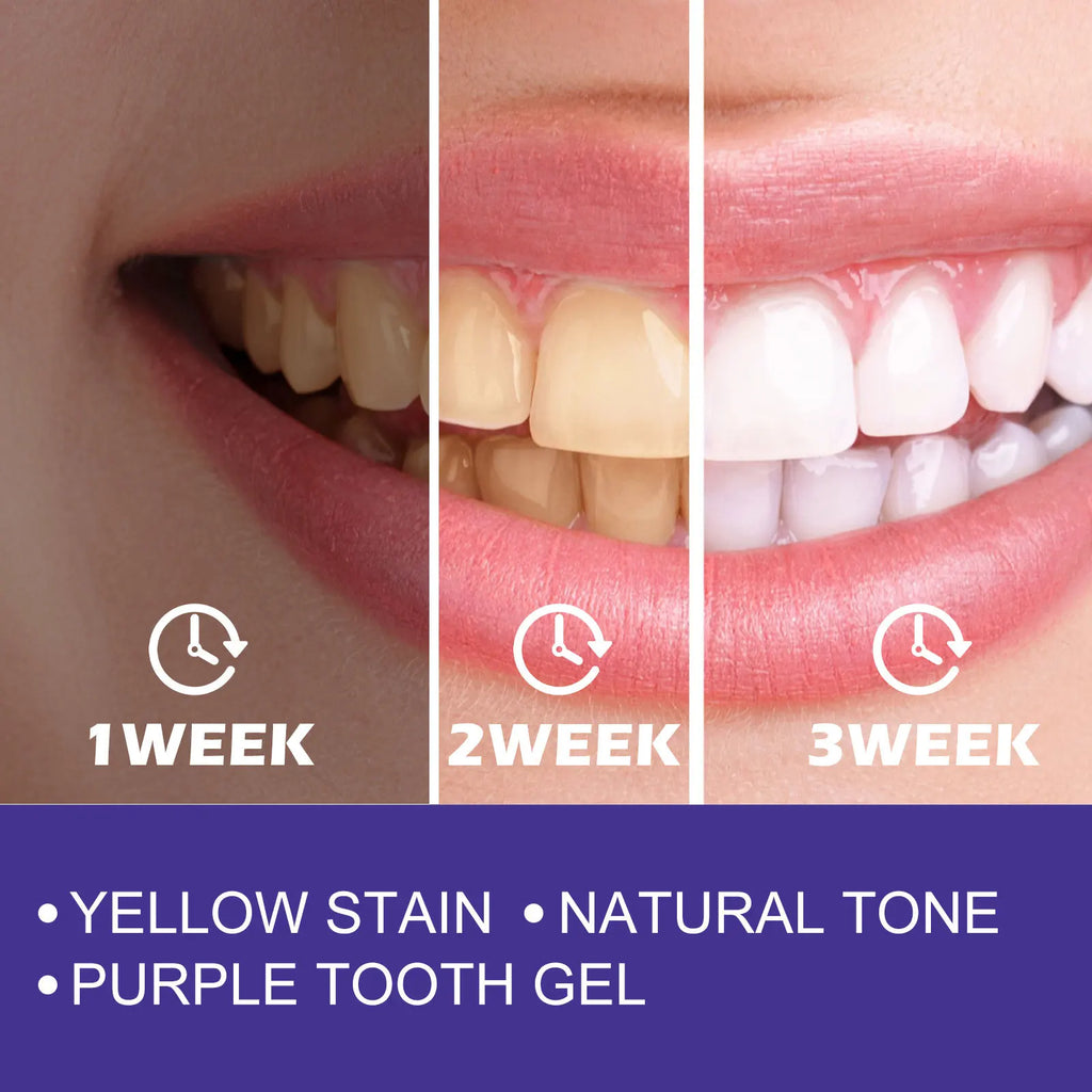 Dentifrice Blanchissant V34 | Correcteur de Couleur Violet & Haleine Fraîche