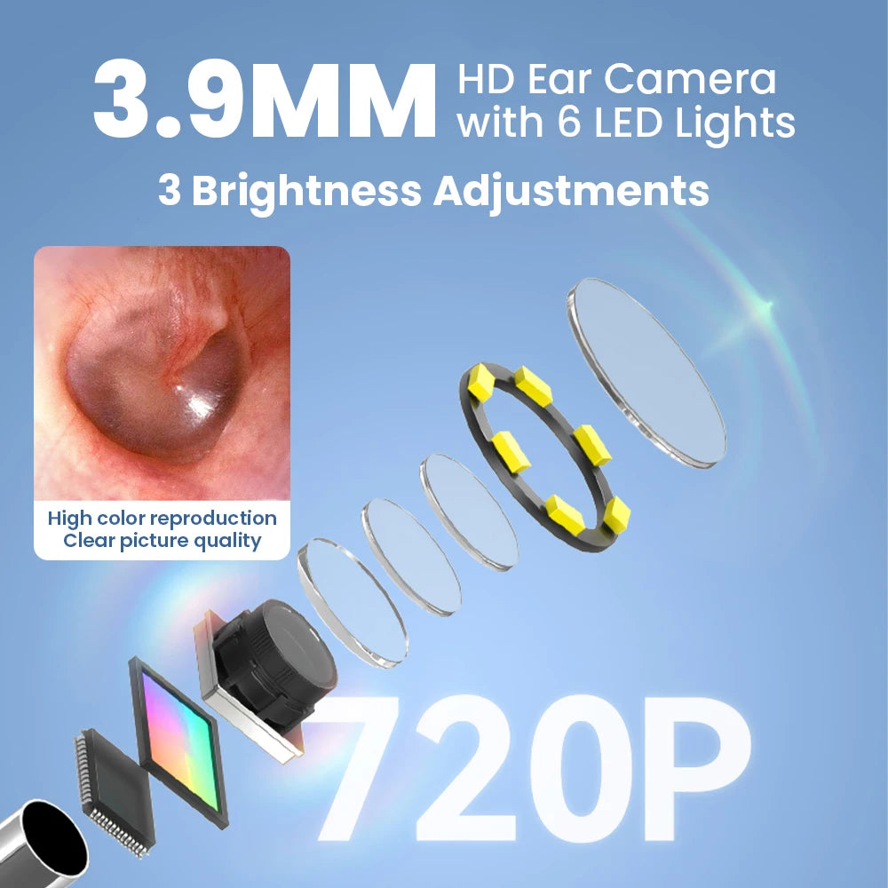 Otoscope Numérique Sinohero SA200 Écran IPS 1,85" Objectif 3,9mm 6 LED 8Go – CLEVI Paris