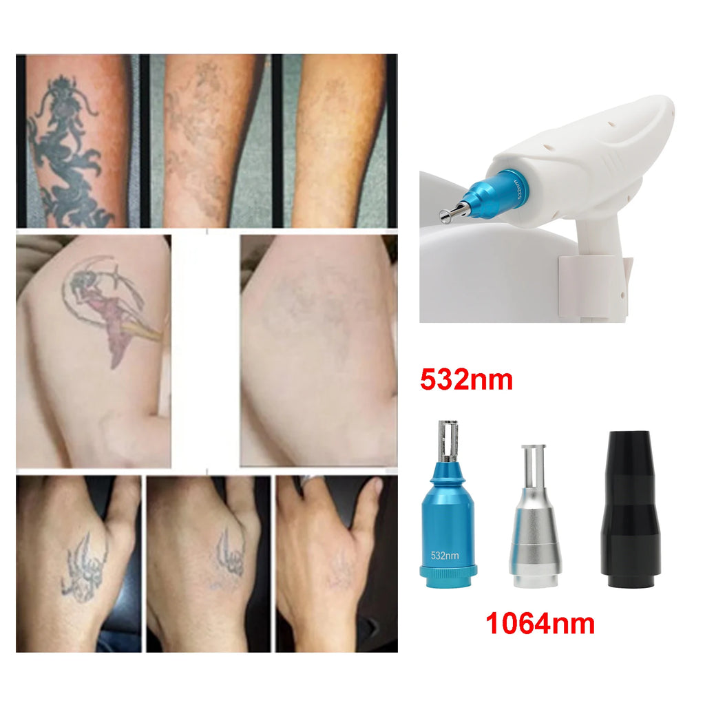 Machine Laser Professionnelle Détatouage & Suppression Pigments | 3 Têtes 1064nm 532nm 310W – CLEVI Paris