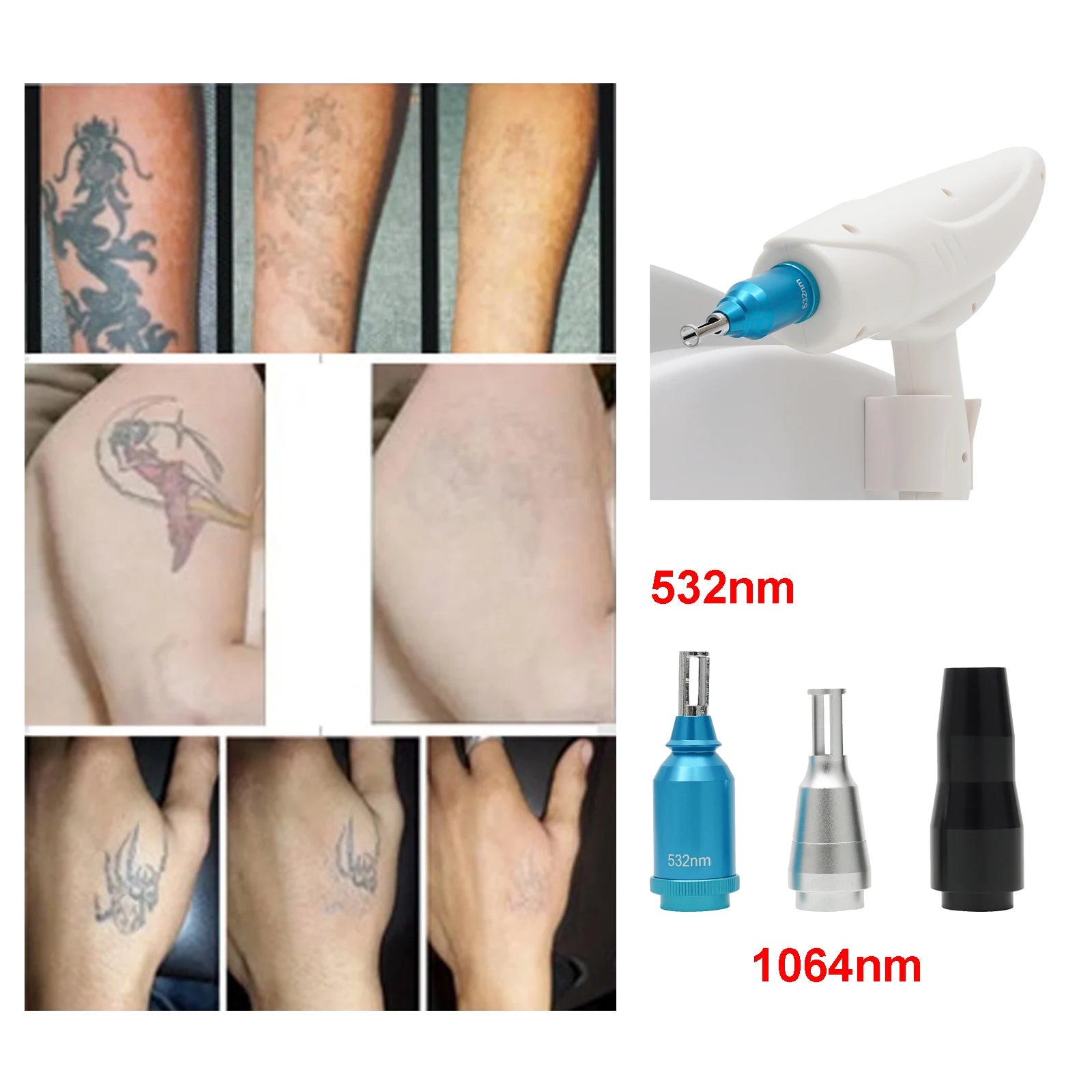 Machine Laser Professionnelle Détatouage & Suppression Pigments | 3 Têtes 1064nm 532nm 310W – CLEVI Paris