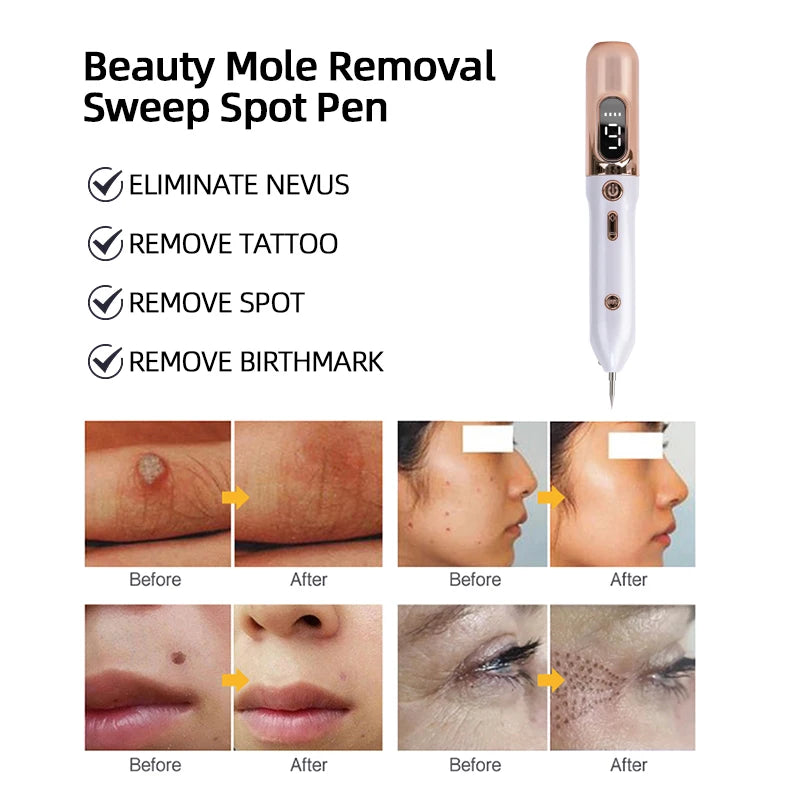 Stylo de soin esthétique 9 niveaux – CLEVI Paris