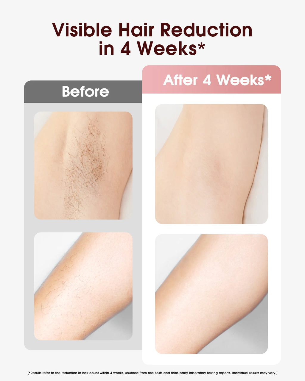 Épilateur IPL LYSMOSKI Refroidissement Cryo 5 Niveaux Épilation Permanente Visage & Corps – CLEVI Paris