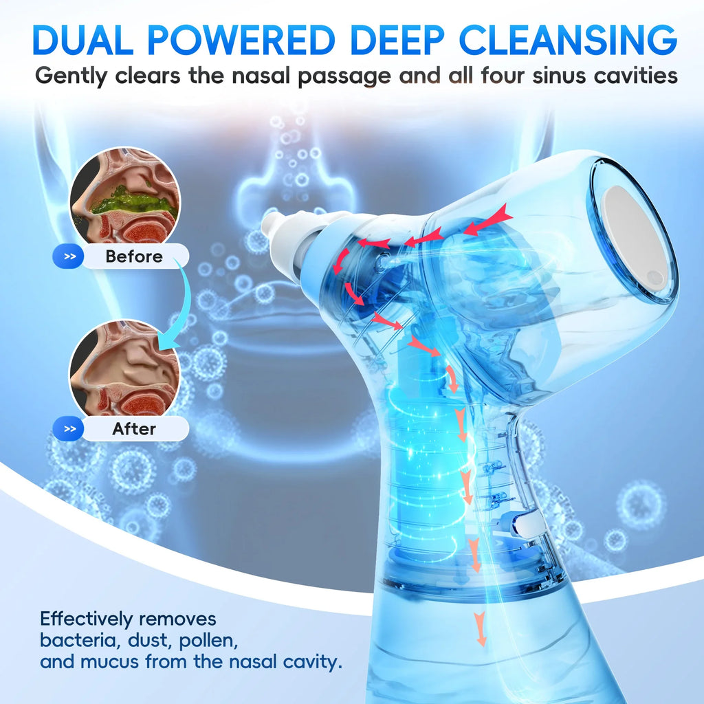 Irrigateur Nasal Électrique Mornwell Double Action Rinçage & Aspiration IPX7 USB-C – CLEVI Paris