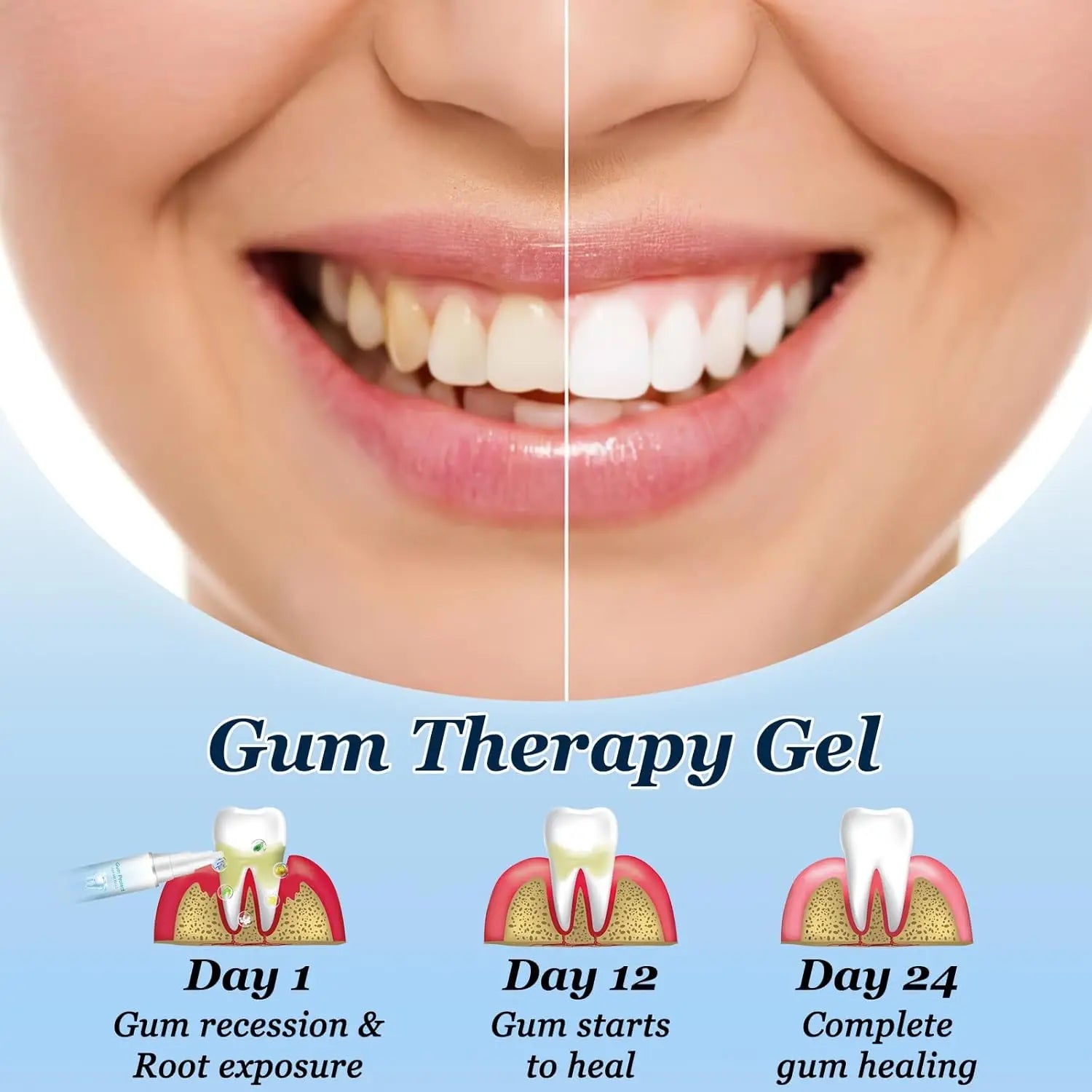 Gel Dentaire Multi-Action | Réparation Gencives, Sensibilité & Anti-Tartre | Certifié CPNP – CLEVI Paris