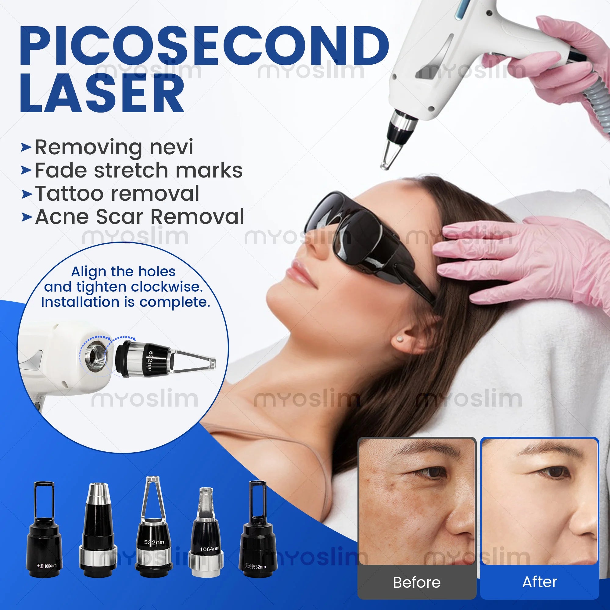 Machine 2-en-1 MYOSLIM 5000W Laser Diode FAC + Picoseconde | Épilation Définitive & Détatouage | 755-808-940-1064nm – CLEVI Paris
