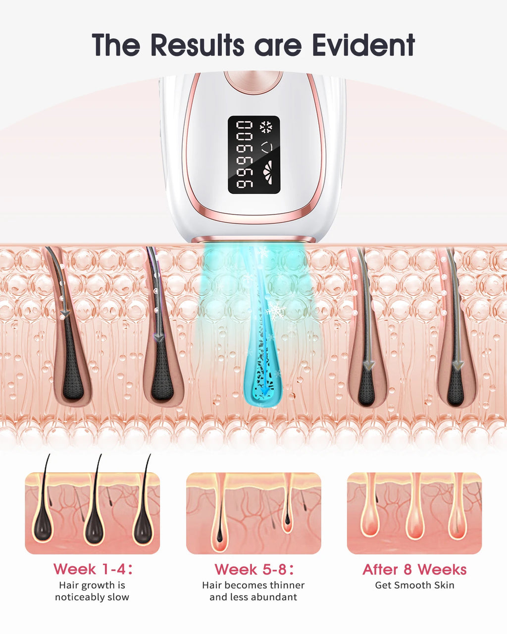 Épilateur IPL LYSMOSKI Refroidissement Cryo 5 Niveaux Épilation Permanente Visage & Corps – CLEVI Paris