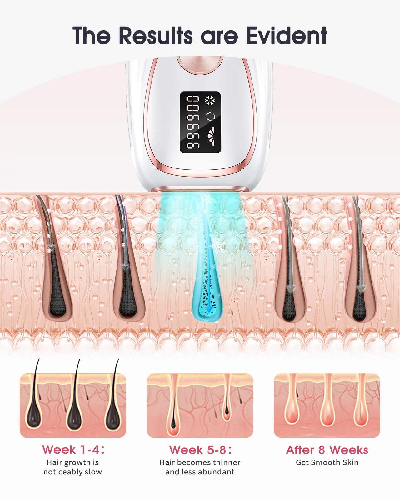 Épilateur IPL LYSMOSKI Refroidissement Cryo 5 Niveaux Épilation Permanente Visage & Corps – CLEVI Paris