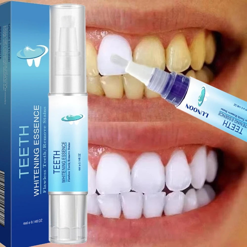 Stylo Blanchissant pour les Dents | Sourire Éclatant & Haleine Fraîche | Soin Dentaire Doux – CLEVI Paris