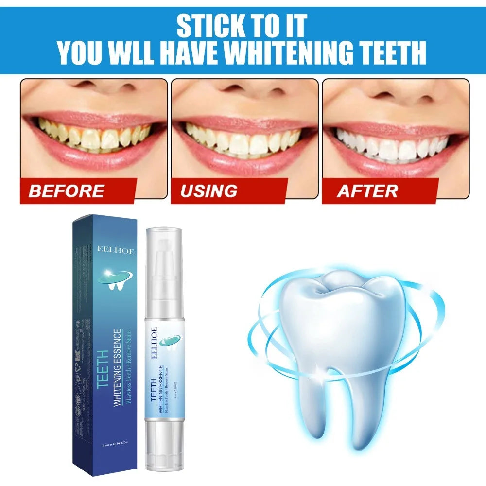 Stylo Blanchissant pour les Dents | Sourire Éclatant & Haleine Fraîche | Soin Dentaire Doux – CLEVI Paris